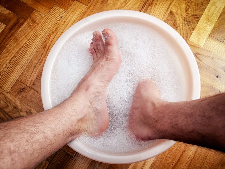 Does Bleach Really Kill Foot Fungus? Find Out the Truth!