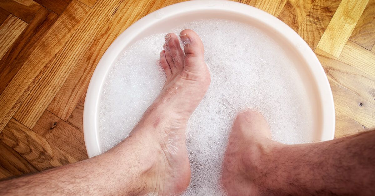 Get Rid of Athletes Foot Fast: Can Bleach Really Be the Answer?